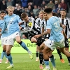 Newcastle vs Manchester City Prediction 7 March 2026